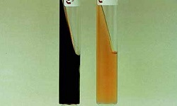 Bile Esculin Test